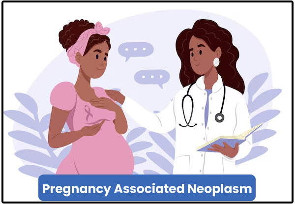 Pregnancy Associated Neoplasm